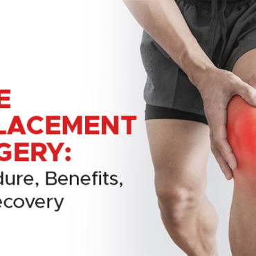 Knee Replacement Surgery