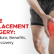 Knee Replacement Surgery